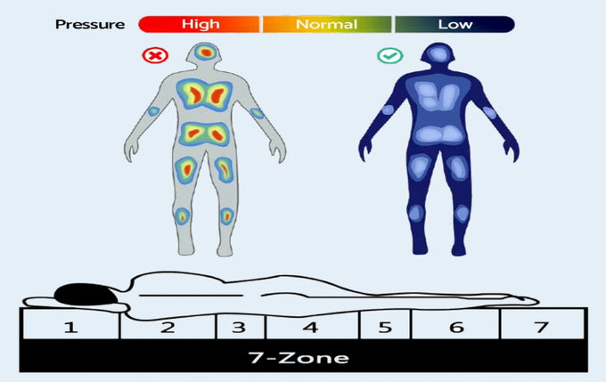  Pressure relief and support